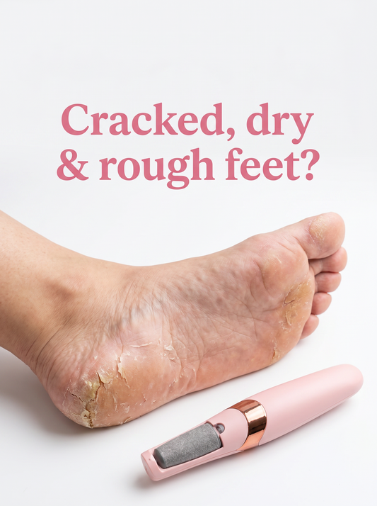 Cracked, dry and rough feet - solé.
