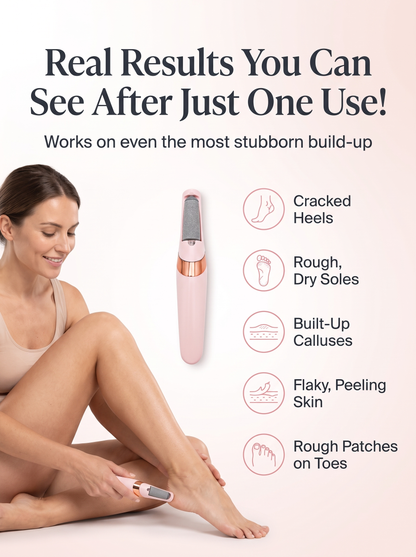 Solé Electric Callus Remover